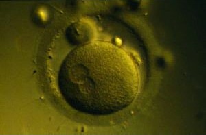 A very early photo of Adam